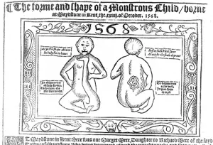 Picture of a monstrous child from a pamphlet printed in 1568