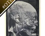 A photo of Henry Grey's head